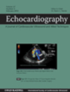 ECHOCARDIOGRAPHY-A JOURNAL OF CARDIOVASCULAR ULTRASOUND AND ALLIED TECHNIQUES