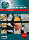Journal of Contemporary Brachytherapy