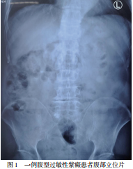 一例腹型过敏性紫癜患者腹部立位片